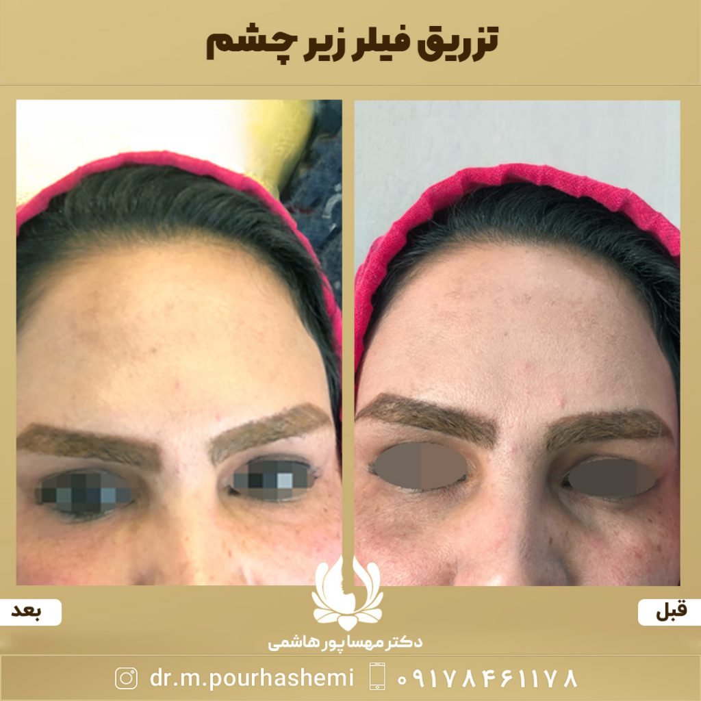 دکتر مهسا پورهاشمی