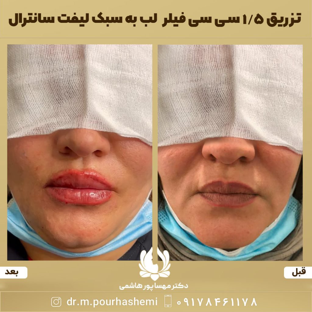 دکتر مهسا پورهاشمی