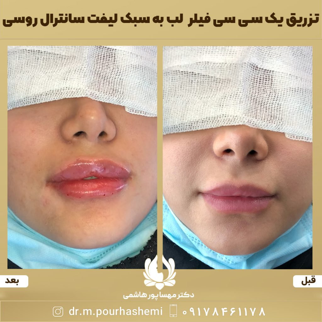 دکتر مهسا پورهاشمی