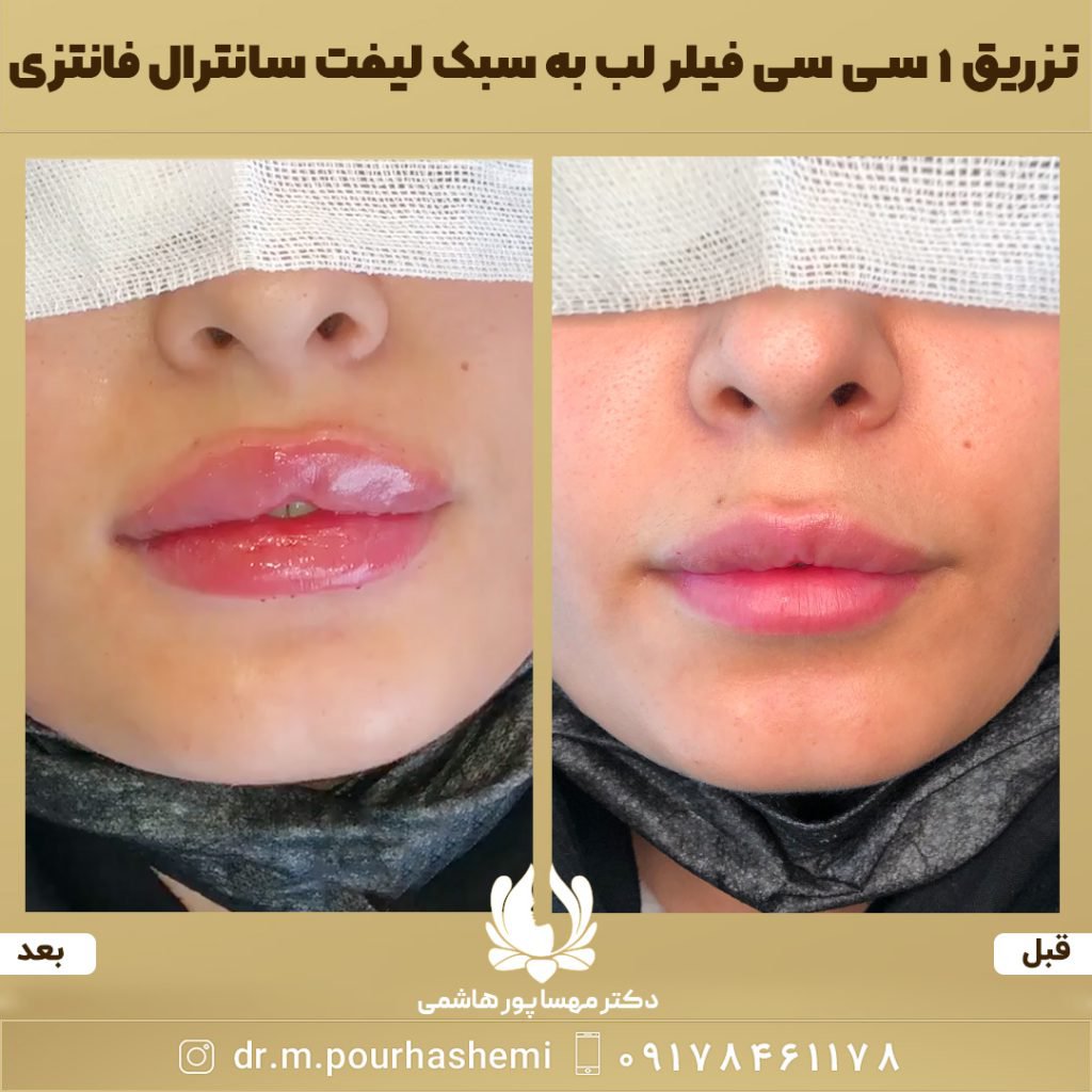 دکتر مهسا پورهاشمی