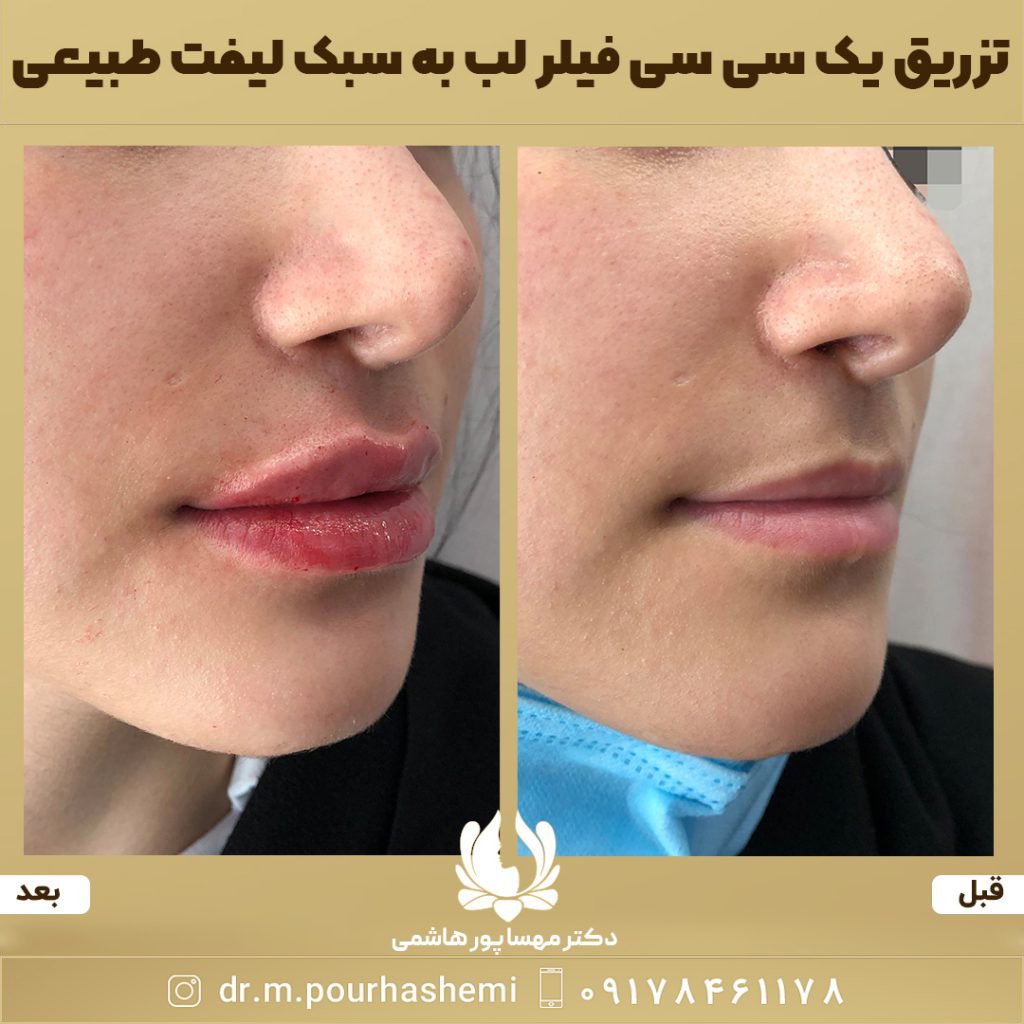 دکتر مهسا پورهاشمی